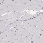 ZFX Antibody in Immunohistochemistry (Paraffin) (IHC (P))