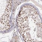 ZFX Polyclonal Antibody