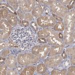 SEMA3G Antibody in Immunohistochemistry (Paraffin) (IHC (P))