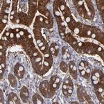 SEMA3G Antibody in Immunohistochemistry (Paraffin) (IHC (P))