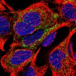 MYOM2 Polyclonal Antibody