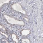 MYOM2 Antibody in Immunohistochemistry (Paraffin) (IHC (P))