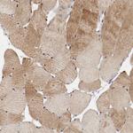 MYOM2 Antibody in Immunohistochemistry (Paraffin) (IHC (P))