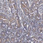 MYOM2 Antibody in Immunohistochemistry (Paraffin) (IHC (P))