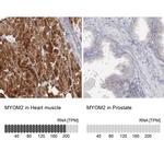 MYOM2 Antibody in Immunohistochemistry (IHC)