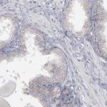 MYOM2 Antibody in Immunohistochemistry (IHC)
