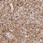 ZC3H7B Polyclonal Antibody