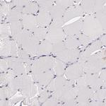 C14orf37 Antibody in Immunohistochemistry (Paraffin) (IHC (P))