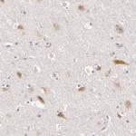 C14orf37 Antibody in Immunohistochemistry (IHC)