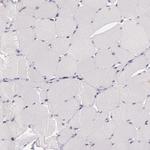 C14orf37 Antibody in Immunohistochemistry (IHC)