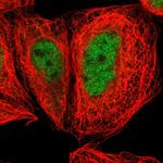 ZNF205 Polyclonal Antibody