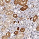 ZNF205 Antibody in Immunohistochemistry (Paraffin) (IHC (P))
