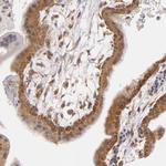 UPF3B Antibody in Immunohistochemistry (Paraffin) (IHC (P))