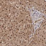 ITIH4 Antibody in Immunohistochemistry (Paraffin) (IHC (P))