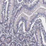 ITIH4 Antibody in Immunohistochemistry (Paraffin) (IHC (P))