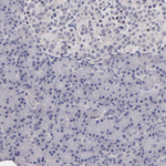 ITIH4 Polyclonal Antibody