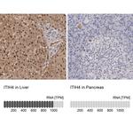 ITIH4 Antibody in Immunohistochemistry (IHC)