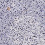 ITIH4 Antibody in Immunohistochemistry (IHC)