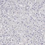 EGFL6 Antibody in Immunohistochemistry (Paraffin) (IHC (P))