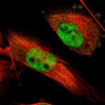 INTS6 Polyclonal Antibody