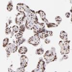 INTS6 Antibody in Immunohistochemistry (Paraffin) (IHC (P))