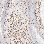 INTS6 Antibody in Immunohistochemistry (Paraffin) (IHC (P))