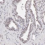 INTS6 Antibody in Immunohistochemistry (Paraffin) (IHC (P))