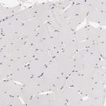 INTS6 Antibody in Immunohistochemistry (Paraffin) (IHC (P))