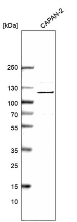 INTS6 Antibody in Western Blot (WB)