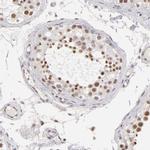 INTS6 Antibody in Immunohistochemistry (IHC)