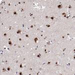 FAM81A Polyclonal Antibody