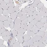 FAM81A Antibody in Immunohistochemistry (IHC)