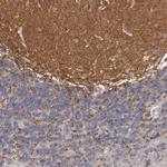 FAT1 Antibody in Immunohistochemistry (Paraffin) (IHC (P))