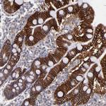 FAT1 Antibody in Immunohistochemistry (Paraffin) (IHC (P))