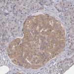 FAT1 Antibody in Immunohistochemistry (Paraffin) (IHC (P))