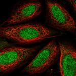 TAF7L Polyclonal Antibody