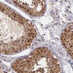 TAF7L Antibody in Immunohistochemistry (Paraffin) (IHC (P))