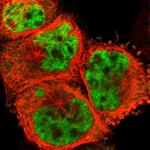 PQBP1 Polyclonal Antibody