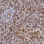 PQBP1 Antibody in Immunohistochemistry (Paraffin) (IHC (P))