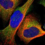 UPF3B Polyclonal Antibody