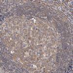 UPF3B Antibody in Immunohistochemistry (Paraffin) (IHC (P))