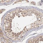 UPF3B Antibody in Immunohistochemistry (Paraffin) (IHC (P))