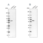 UPF3B Antibody in Western Blot (WB)