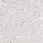 SIX1 Antibody in Immunohistochemistry (IHC)