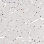 SIX1 Antibody in Immunohistochemistry (IHC)