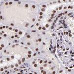 GPKOW Antibody in Immunohistochemistry (IHC)