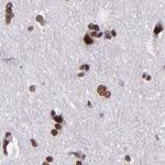 GPKOW Antibody in Immunohistochemistry (IHC)