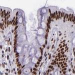 GPKOW Antibody in Immunohistochemistry (IHC)