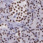 GPKOW Antibody in Immunohistochemistry (IHC)
