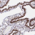 GPKOW Antibody in Immunohistochemistry (IHC)
